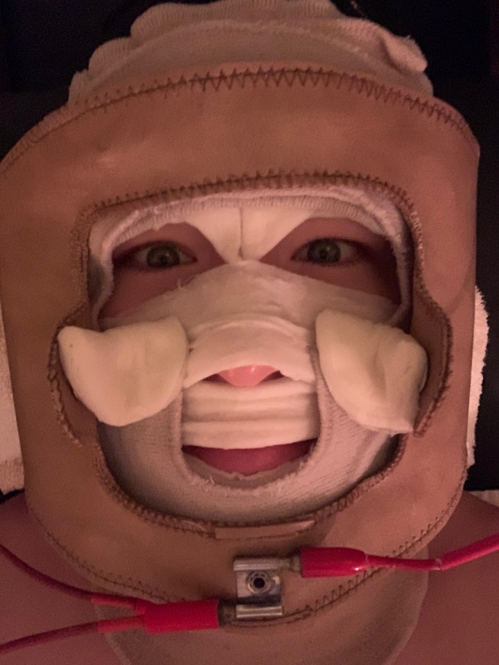 My First Electrotherapy Facial (Galvanic&nbsp;facail)